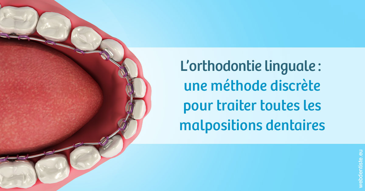 https://www.orthodontistenice.com/L'orthodontie linguale 1