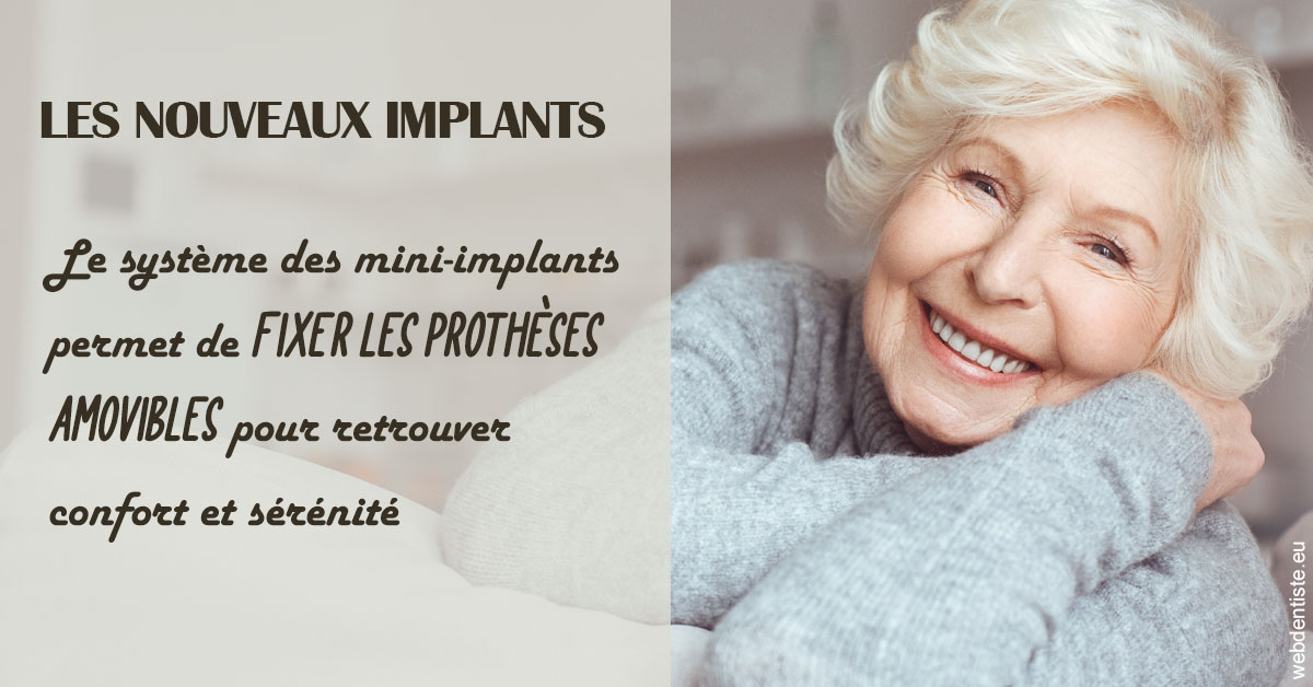 https://www.orthodontistenice.com/Les nouveaux implants 1