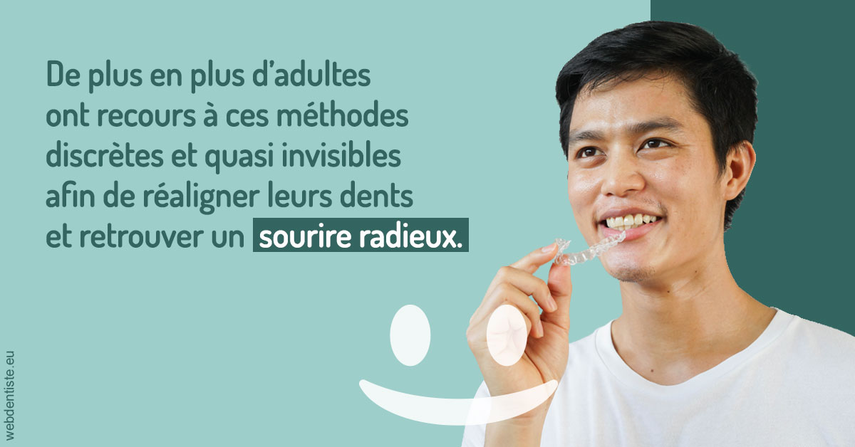 https://www.orthodontistenice.com/Gouttières sourire radieux 2