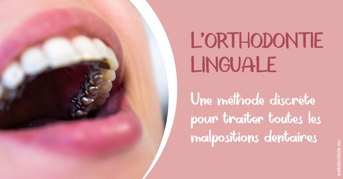 https://www.orthodontistenice.com/L'orthodontie linguale 2