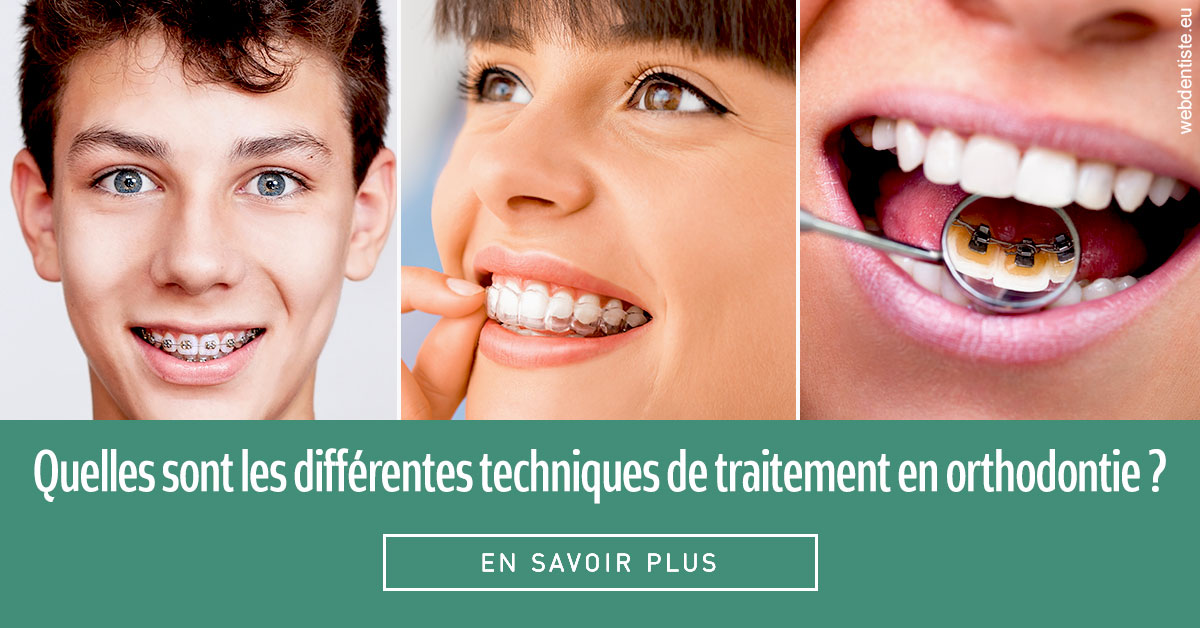 https://www.orthodontistenice.com/Les différentes techniques de traitement 2