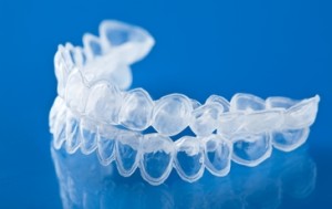 La période de contention orthodontique