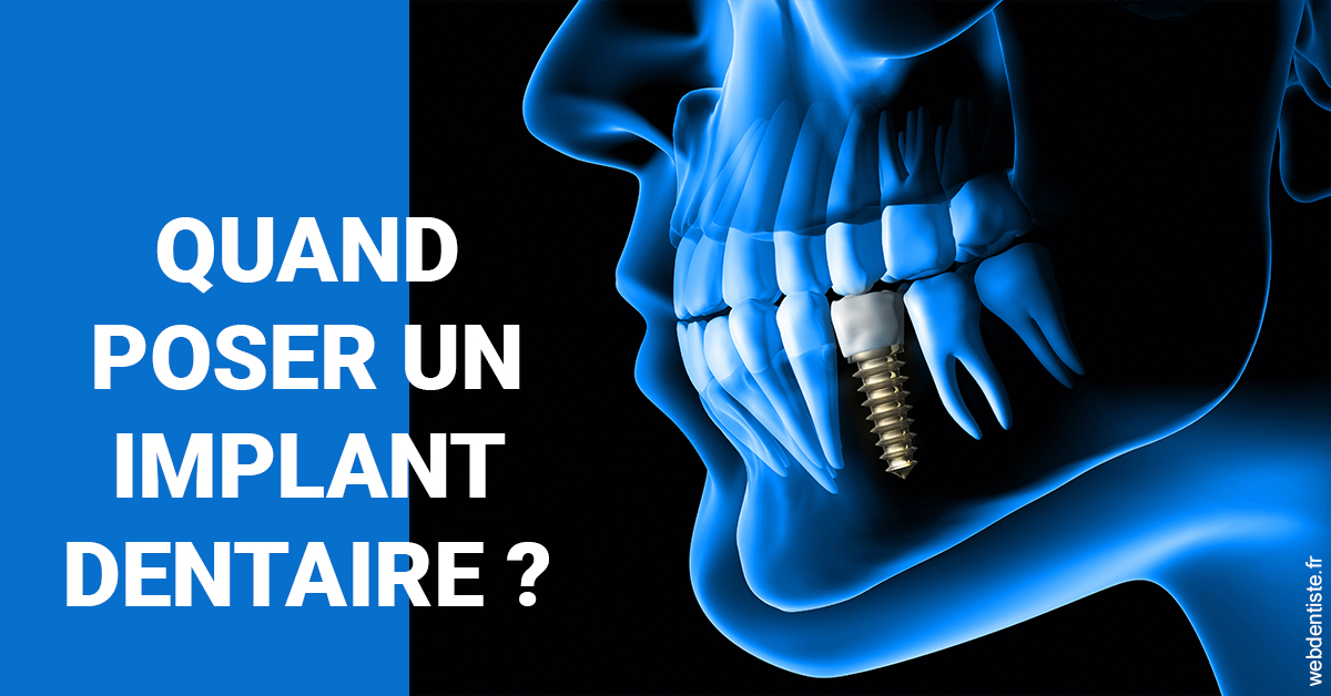 https://www.orthodontistenice.com/Les implants 1