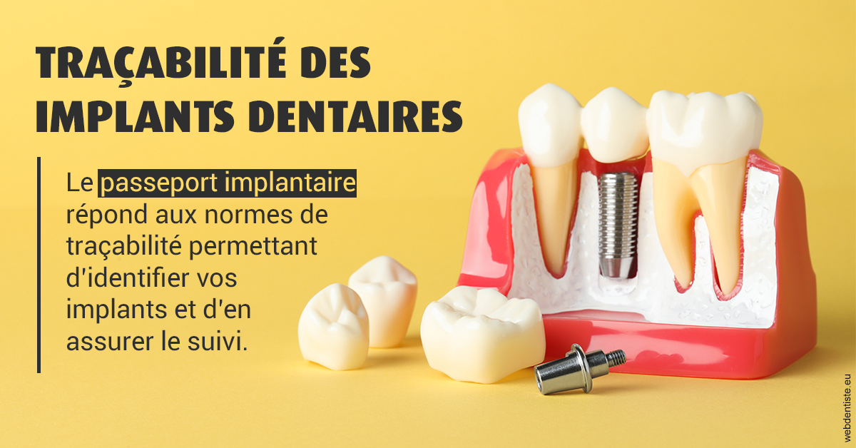 https://www.orthodontistenice.com/T2 2023 - Traçabilité des implants 2