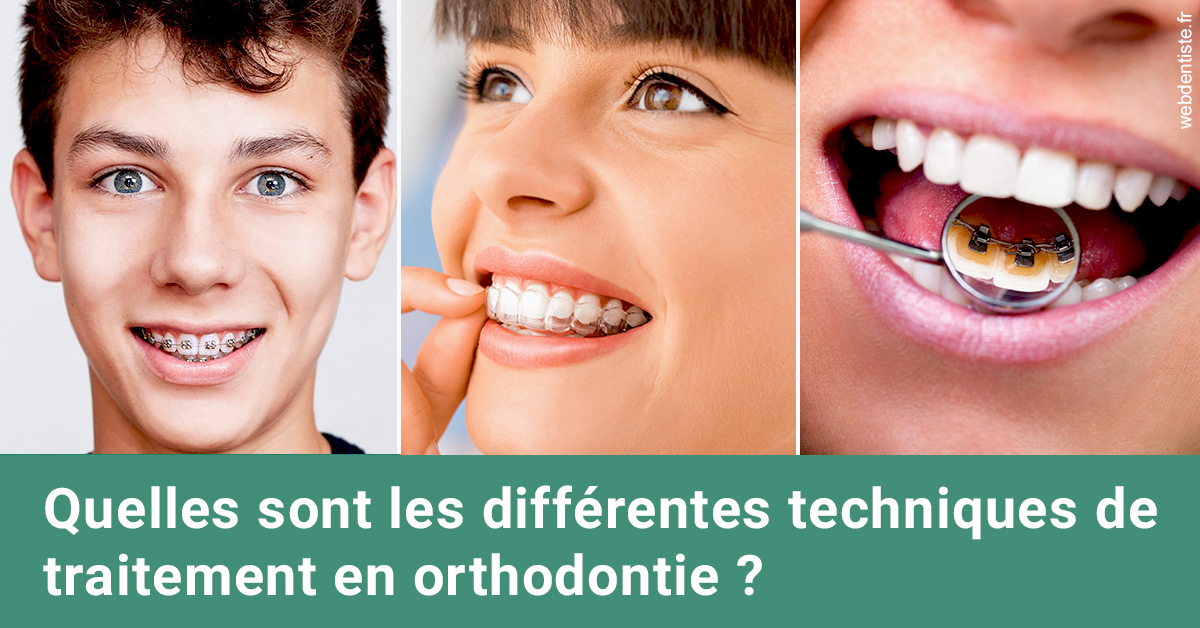 https://www.orthodontistenice.com/Les différentes techniques de traitement 2