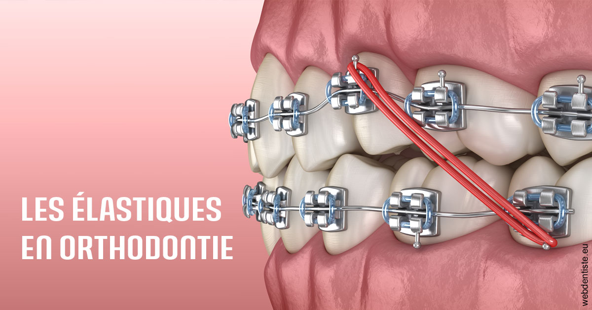 https://www.orthodontistenice.com/Elastiques orthodontie 2