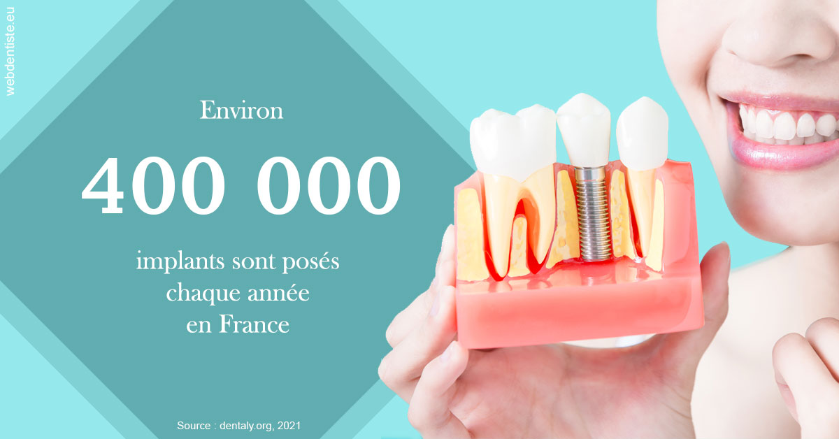 https://www.orthodontistenice.com/Pose d'implants en France 2